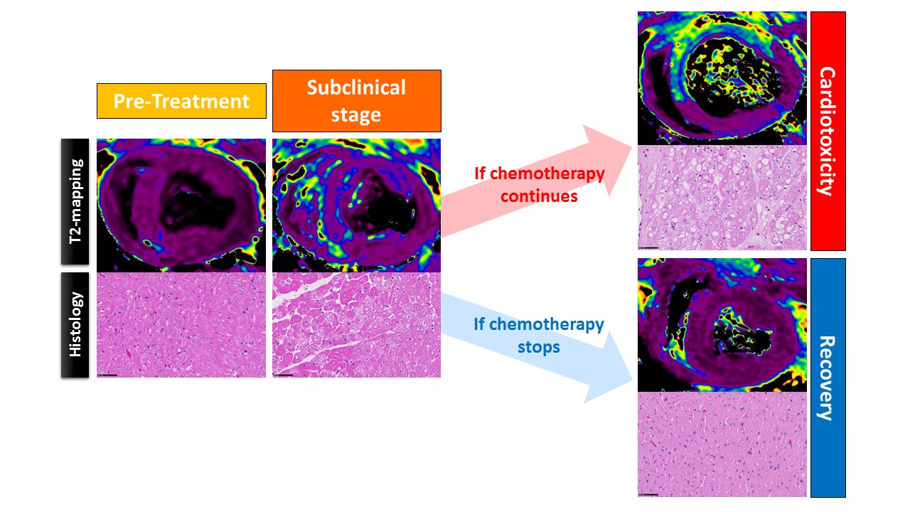 Imágenes de resonancia magnética (mapas de T2 o T2 mapping) y la correspondiente histología de animales que fueron tratados con antraciclinas. La fase de daño subclínica se caracteriza por una alteración del T2 mapping que traduce un edema en los cardiomiocitos. CNIC. 